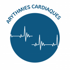 Arythmies cardiaques