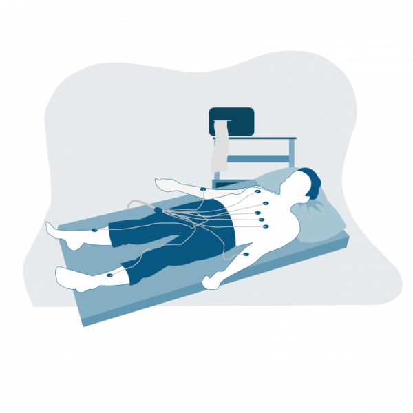 ELECTROCARDIOGRAMME ECG