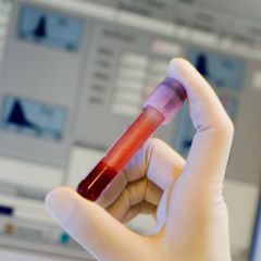 pole_biologie_pathologie_chu_bordeaux