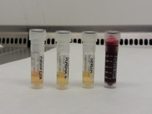 6 fractions sanguines