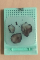 4 tissus fixés