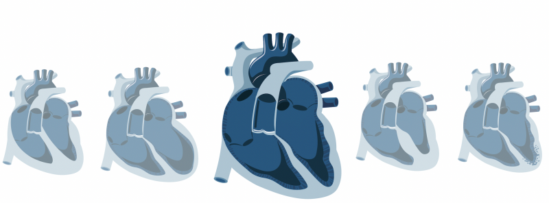 Myocardiopathies Myocardiopathies