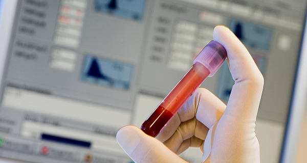 laboratoire_hematologie_biologique