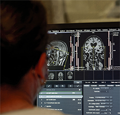 service de radiologie et de neuro-imagerie diagnostique et thérapetique - imag service de radiologie et de neuro-imagerie diagnostique et thérapetique - imagerie des urgences (pellegrin)