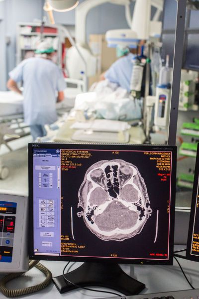 AVC service CHU cerveau