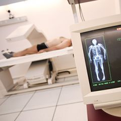 service_medecine_nucleaire_chu_bordeaux
