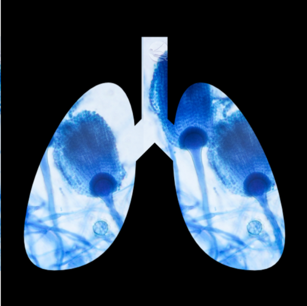 Des travaux transdisciplinaires bordelais mis à l'honneur par l'Académie américaine d'allergie, d'asthme et d'immunologie (AAAI)