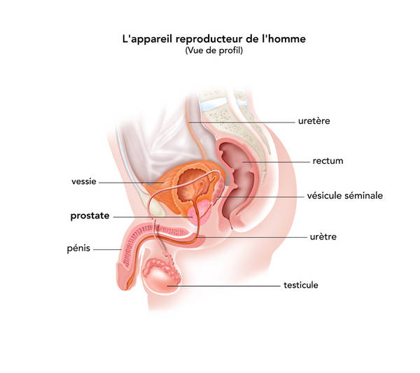 Cancer de la prostate