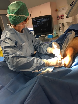 article sur les varices