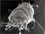 dermatologie_gale_chu_de_bordeaux