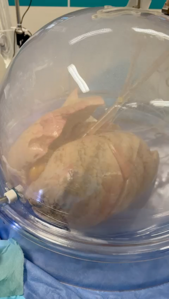 poumon sous perfusion Poumon sous bulle perfusion