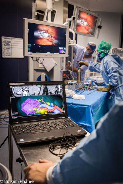 colonne vidéo - chirurgie robotique colonne vidéo - chirurgie robotique