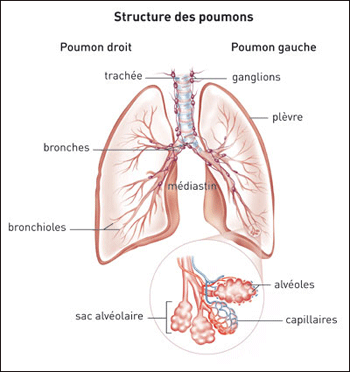 Cancer des poumons