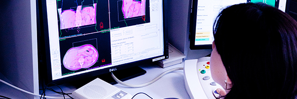 service-radiotherapie-chu-bordeaux