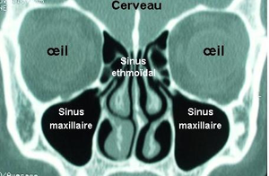cancer-nez-sinus-chu-bordeaux