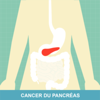 vignettecancerdupancreascopyrightinc-1583235341