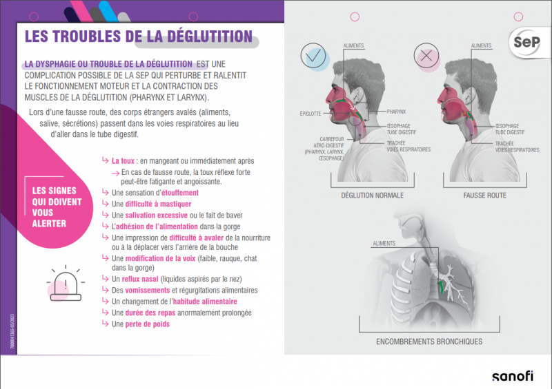 troubles déglutition sanofi 1 2023