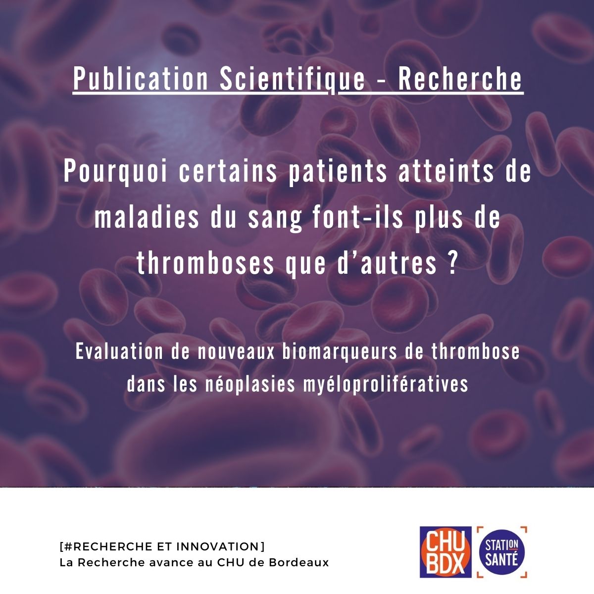 Publication dans Leukemia - La thromboinflammation est associée à un risque thrombotique élevé chez les patients présentant des néoplasmes myéloprolifératifs nouvellement diagnostiqués